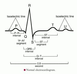 electrocardiogram.jpg